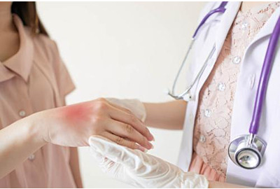 Dermatologe, der die Hand des Patienten mit Hautrötung im Krankenhaus untersucht.